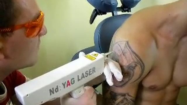 Удаление татуировки.AVI смотреть онлайн