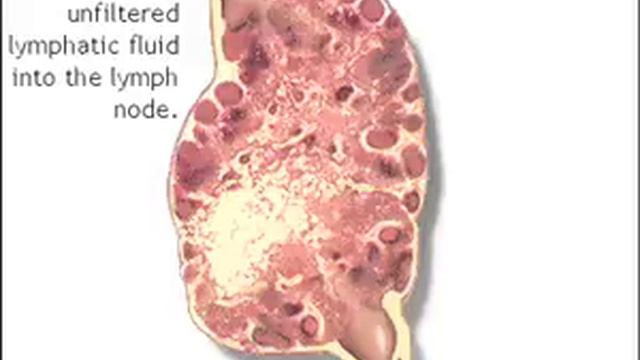 Lymph nodes - Anatomy Video - смотреть онлайн