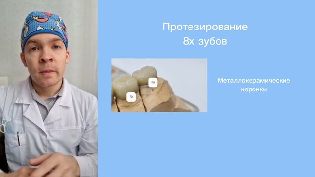 Зуб мудрости у взрослых и детей. Обзор при неправильном положении. Лечение, протезирование, удалени смотреть онлайн