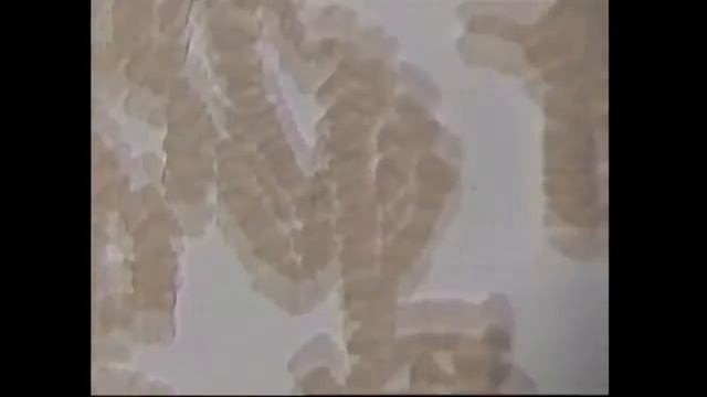 Тестирование капли крови (темнопольный микроскоп) до и после приема продуктов Coral Club