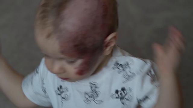 ГИГАНТСКИЙ НЕВУС | История Димы Чабанюка смотреть онлайн