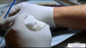 Циркониевые коронки: зубные коронки на основе диоксида циркония.