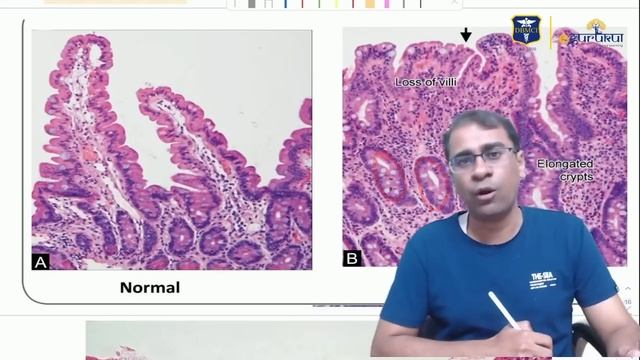 Let's revise GIT | 10 Minutes Revision with Dr. Praveen Kumar Gupta смотреть онлайн