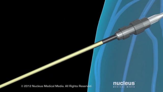 Общая анестезия смотреть онлайн