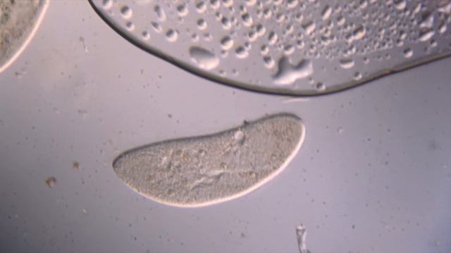 Инфузория смотреть онлайн