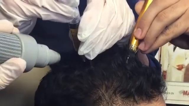 Dr.Saul does PRP Treatment ? смотреть онлайн