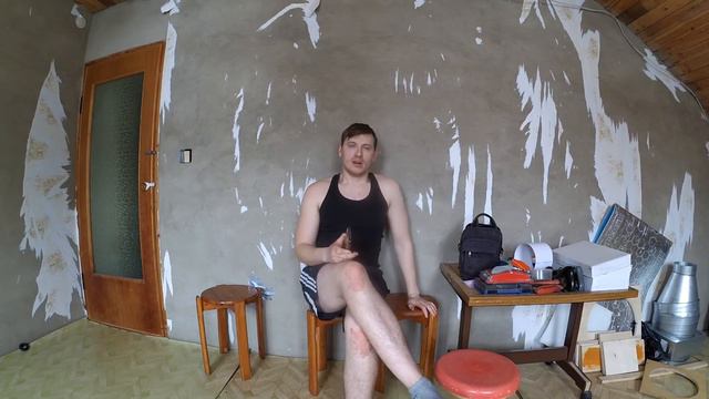 Ответы на вопросы зрителей №3 Эндопротезирование ТБС смотреть онлайн