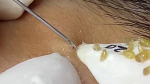 Enjoy Your Day With Hien Nguyen Spa # 1843