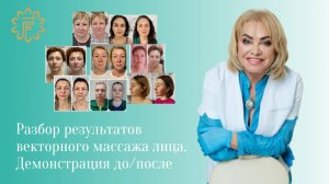 Разбор результатов векторного массажа лица. Демонстрация до/после.