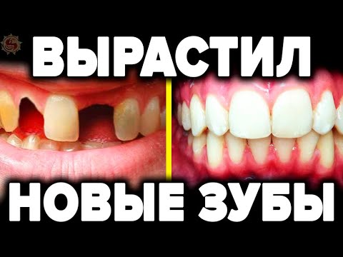 Выращивание новых зубов - 5 секретных техник о которых молчат стоматологи смотреть онлайн