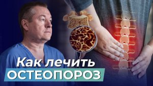 Какой ЭФФЕКТИВНЫЙ МЕТОД ЛЕЧЕНИЯ при ОСТЕОПОРОЗЕ? Советы по Лечению и Профилактике