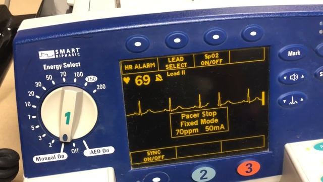 Trancutaneously pacing with the Phillips heart start monitor смотреть онлайн
