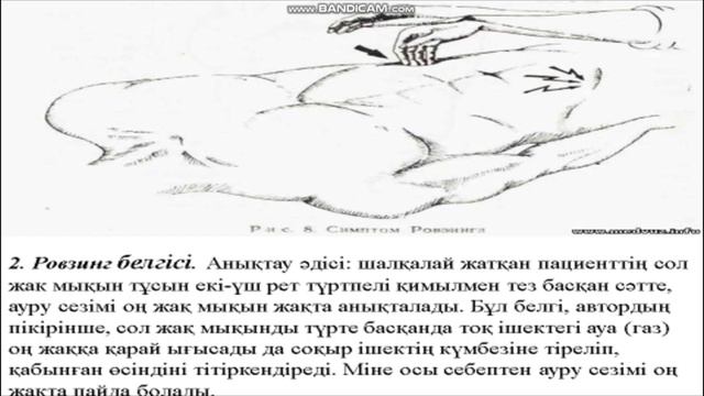 Жедел аппендицит смотреть онлайн