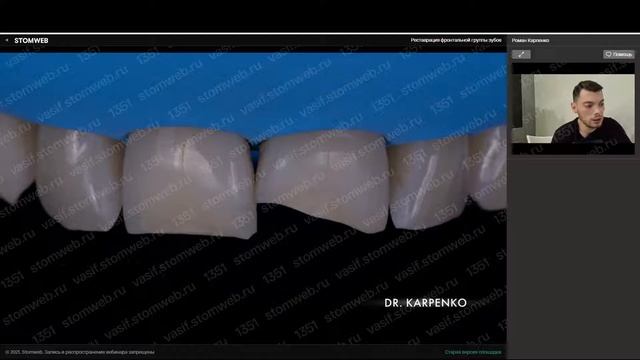 Роман Карпенко - Реставрация фронтальной группы зубов смотреть онлайн