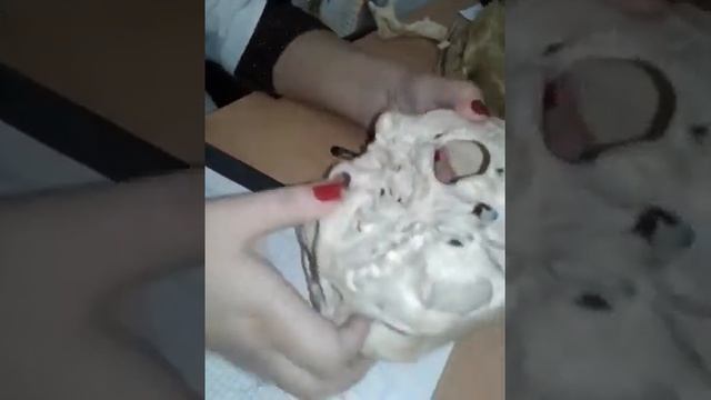 Каналы височной кости смотреть онлайн