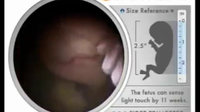 Кусок мяса? Уникальное видео! смотреть онлайн