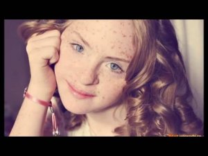 Крымский репортер. Синдром Дауна.