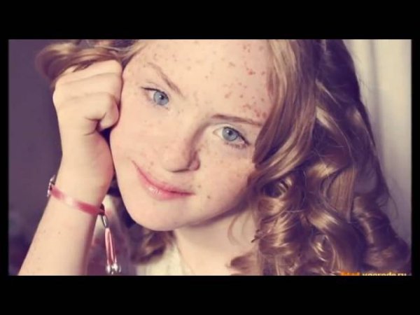 Крымский репортер. Синдром Дауна.