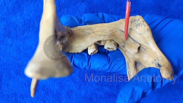 MANDIBLE OSTEOLOGY смотреть онлайн