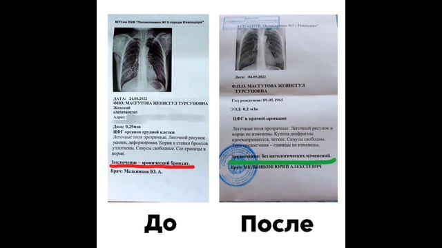 Marine Health. Отзыв: Хронический бронхит, 100% результат. смотреть онлайн
