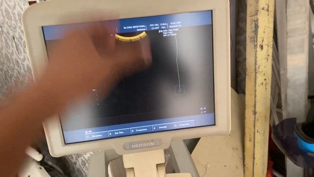 Sonoace X6 testing смотреть онлайн