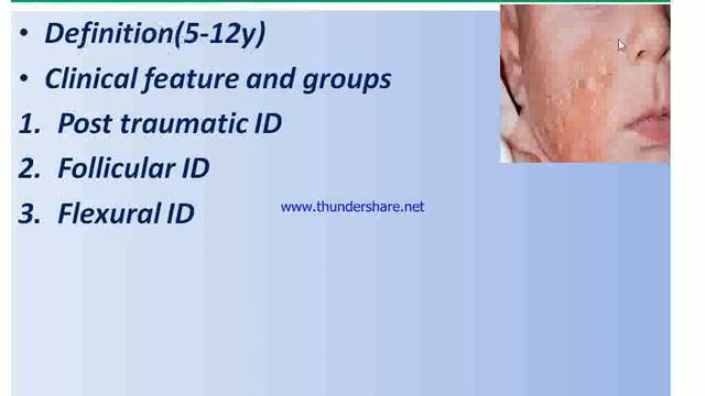 4S2 Dermatology L3 A,B,C Sections Dr Ihsanullah Eczema 1 смотреть онлайн