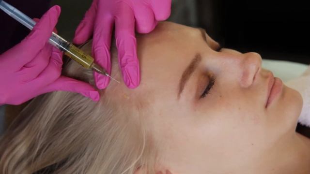 Всем купон. Контурная пластика губ, скул, коррекция формы носа "Eridan" смотреть онлайн