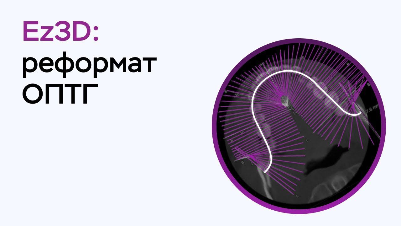 Возможности программы Ez3D: реформат ОПТГ смотреть онлайн