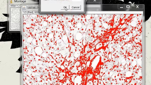 Quantifying Stained Liver Tissue Area Using ImageJ смотреть онлайн