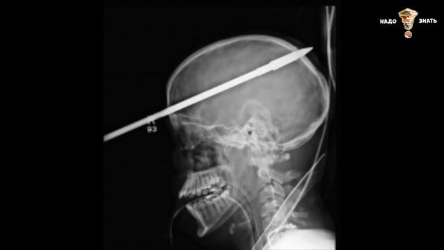 Мистическое наследие