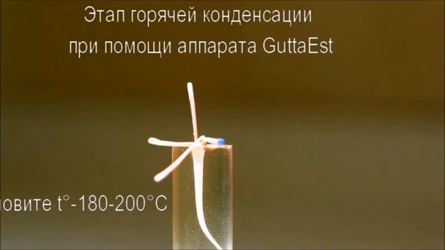 Пломбирование корневых каналов гуттаперчей. Латеральная конденсация. Эндодонтия. Стоматология.