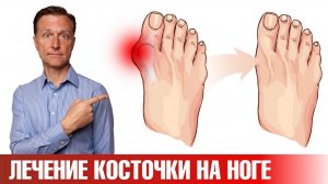 Эти 5 упражнений помогут убрать косточку на большом пальце ноги✅