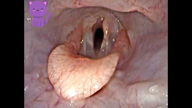 Normal function of thefeline larynx /Нормальная функция гортани у кошки смотреть онлайн