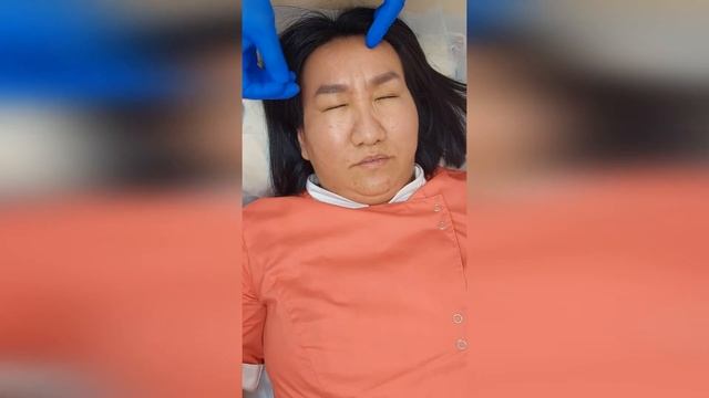 Иглорефлексотерапия для улучшения зрения смотреть онлайн