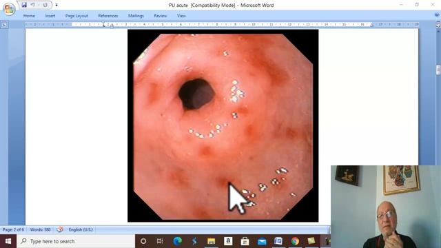Gastric disorders in Arabic 1 ( Acute peptic ulcer ) , by Dr. Wahdan. смотреть онлайн