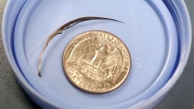 Эта малышка постоянно почесывала шею. Причина удивила даже бывалых врачей смотреть онлайн