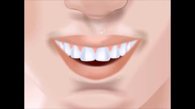 Как определить цвет зуба. Ортопедическая стоматология. смотреть онлайн