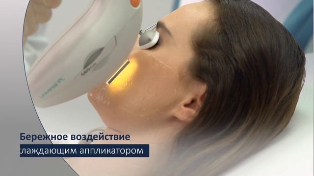 Процедура Optima™ IPL от Lumenis