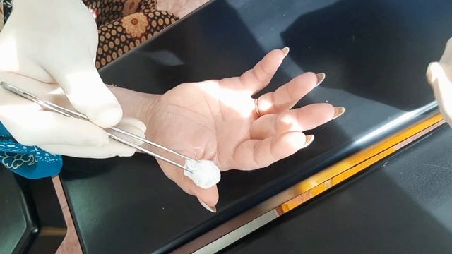 Блокада. Укол в палец. Болезнь Нотта. Стенозирующий лигаментит смотреть онлайн
