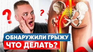 Признаки и лечение ГРЫЖИ поясничного отдела позвоночника. Можно ли избежать операции?