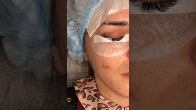 Наращивание ресниц,процесс наращивания ресниц,как подтянуть и проработать внешний угол смотреть онлайн