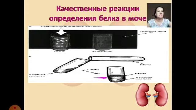 Общий анализ мочи Микроскопия осадка мочи смотреть онлайн