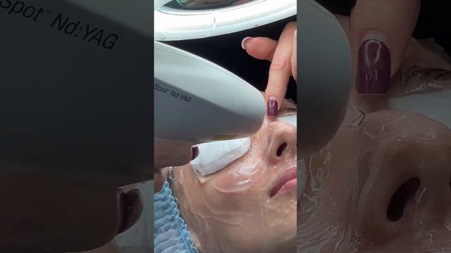 ФОТООМОЛОЖЕНИЕ М22