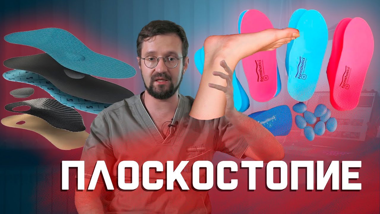 Что помогает при плоскостопии? Стельки, ходьба босиком или массаж стопы? | Мнение о... смотреть онлайн