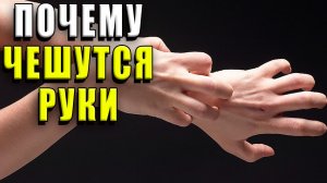Почему чешутся руки
