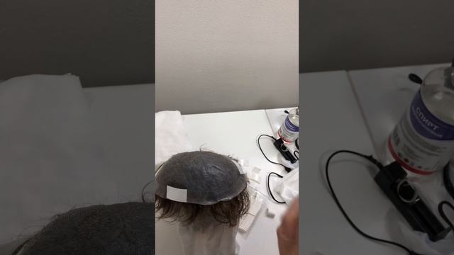 Как зафиксировать (прикрепить) ленты на мужскую систему волос на силиконе? Перефиксация смотреть онлайн