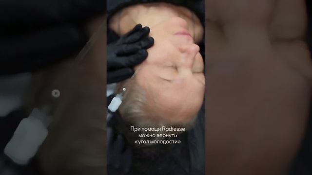 #косметология #уход #кожа #лицо #морщины #аппарат #иньекции #укол #губы #маски moscow #medstone смотреть онлайн