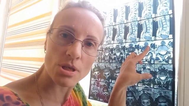 Результат Сколиоз, протрузия позвоночника,защимление шейного отдела. смотреть онлайн