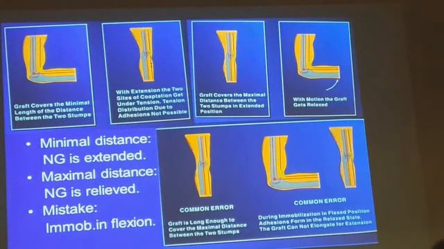 Пластика нервов (prof. Hanno Millesi) ч.1