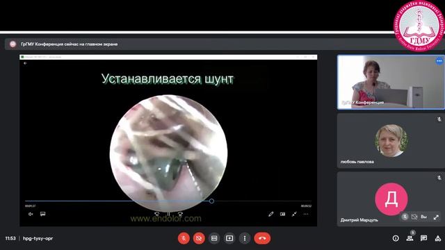 Областная онлайн-конференция «ШКОЛА ОТОРИНОЛАРИНГОЛОГИИ» смотреть онлайн